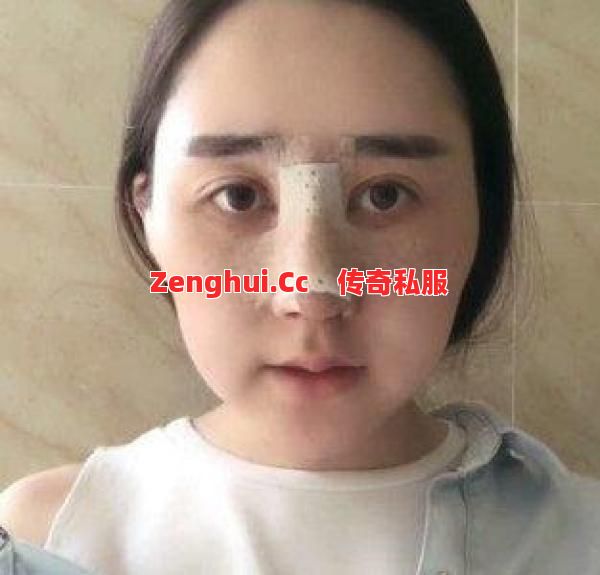 传奇SF那个猪鼻子女孩，现在还好吗？ 